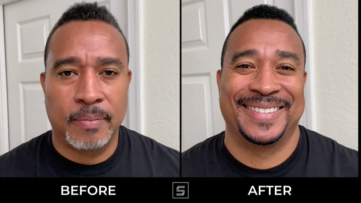 Before and after