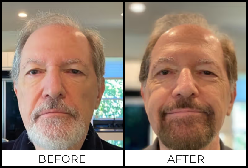 KENNETH P. — before and after using SIMPLER