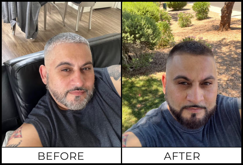 LAURIEL D. — before and after using SIMPLER