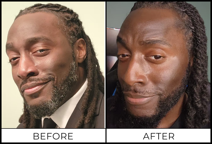 WESLEY R. — before and after using SIMPLER